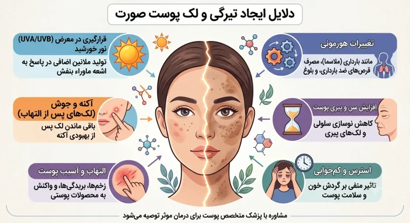 دلایل ایجاد تیرگی و لک پوست صورت دلایل ایجاد تیرگی و لک پوست صورت
