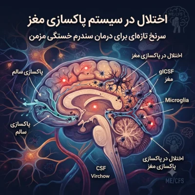 اختلال در سیستم پاکسازی مغز؛ سرنخ تازه‌ای برای درمان سندرم خستگی مزمن
