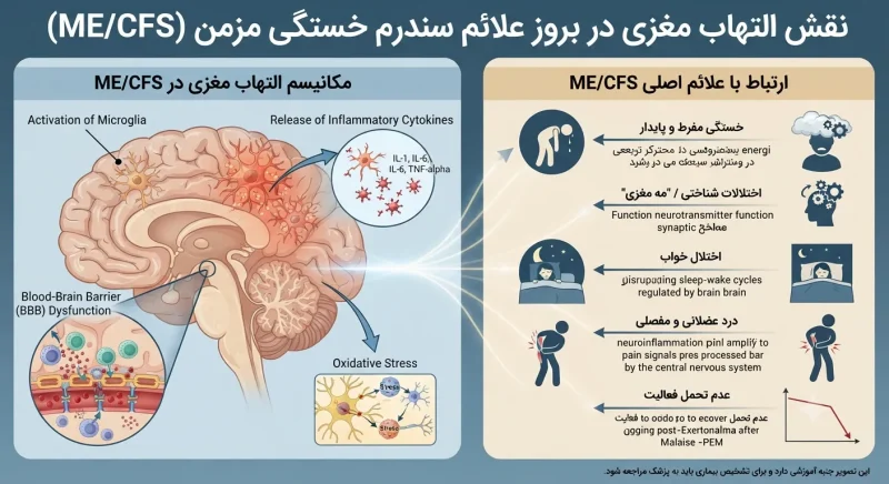 التهاب مغزی و خستگی مزمن نقش التهاب مغزی در بروز علائم سندرم خستگی مزمن