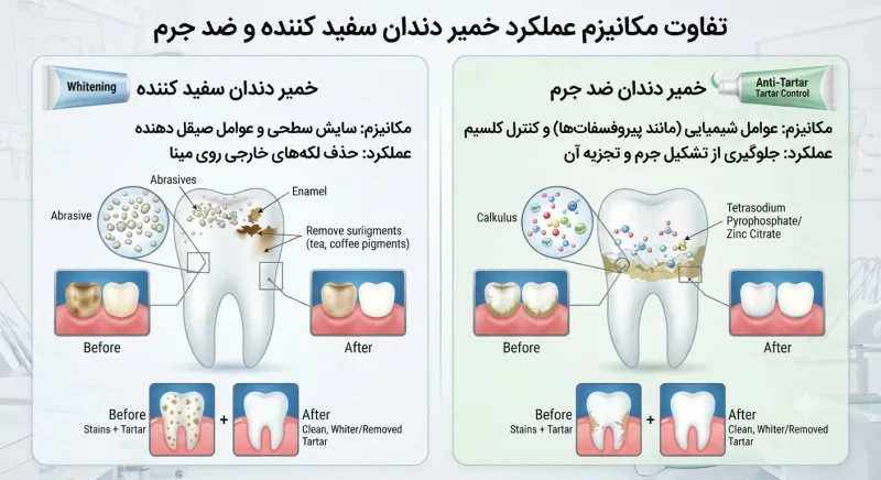 تفاوت مکانیزم عملکرد خمیر دندان سفید کننده و ضد جرم روی دندان