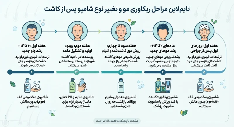 اینفوگرافیک تایم‌لاین مراحل ریکاوری مو و تغییر نوع شامپو در هر مرحله از کاشت مو