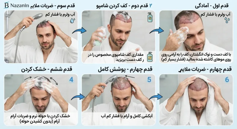 تصویر آموزش گام به گام روش صحیح شستشوی موهای کاشته شده با ضربات ملایم کف دست