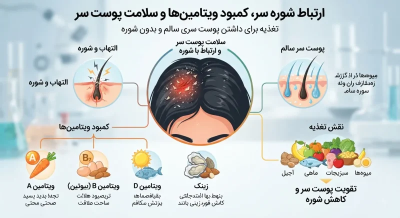 ارتباط شوره سر با کمبود ویتامین‌ها و سلامت پوست کف سر