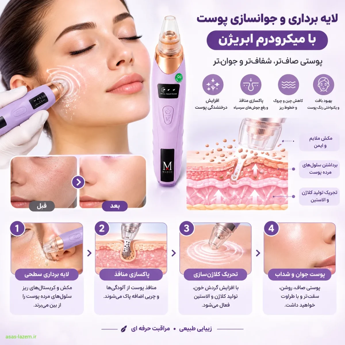 فرآیند لایه برداری و جوانسازی پوست با میکرودرم ابریژن